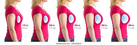 8 468 Women Breast Implants Immagini Foto Stock E Grafica Vettoriale