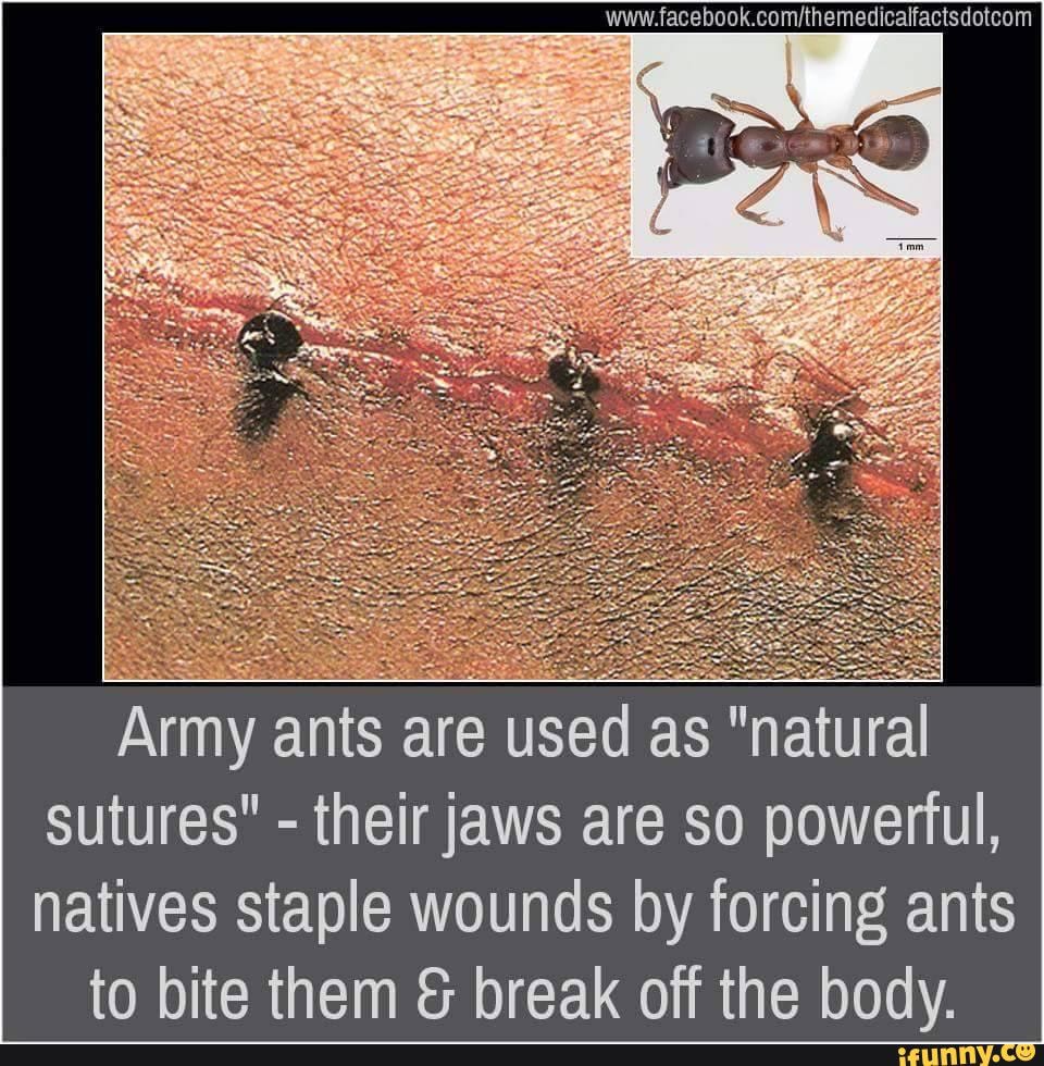 Leaving Us In Stitches Facebook Comithemedicalfactsdotcom Army Ants